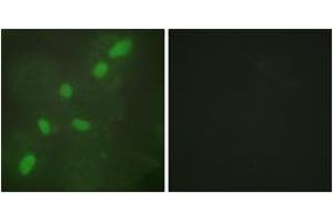 Immunofluorescence (IF) image for anti-Heterogeneous Nuclear Ribonucleoprotein A2/B1 (HNRNPA2B1) (AA 1-50) antibody (ABIN2889424) (HNRNPA2B1 anticorps  (AA 1-50))