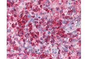 Human Heart; EAP30 antibody - N-terminal region in Human Heart cells using Immunohistochemistry (SNF8 anticorps  (N-Term))