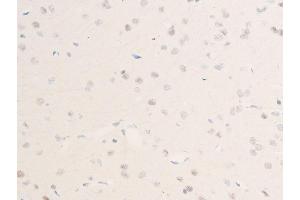 ABIN6256255 and ABIN6267223 at 1/100 staining rat brain tissue sections by IHC-P.