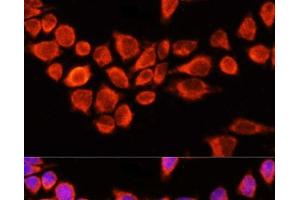 Immunofluorescence analysis of 293T cells using AADAC Polyclonal Antibody at dilution of 1:100 (40x lens). (AADAC anticorps)