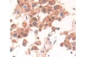IHC-P analysis of pancreas tissue, with DAB staining. (UBA52 anticorps  (AA 1-128))