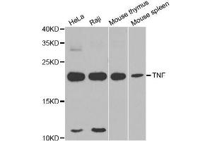 Western blot analysis of extracts of various cell lines, using TNFα antibody. (TNF alpha anticorps  (AA 1-233))