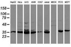 Image no. 8 for anti-Cytochrome P450, Family 2, Subfamily A, Polypeptide 6 (CYP2A6) antibody (ABIN1497724)