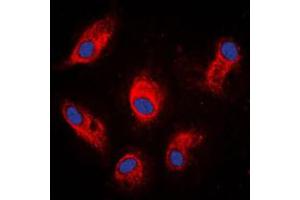 Immunofluorescent analysis of Involucrin staining in MCF7 cells. (Involucrin anticorps  (C-Term))