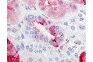Anti-EP2 antibody IHC of human kidney.