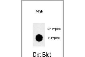 Dot blot analysis of anti-Phospho-JMJD1B-p Phospho-specific Pab (ABIN650878 and ABIN2839821) on nitrocellulose membrane. (KDM3B anticorps  (pSer291))