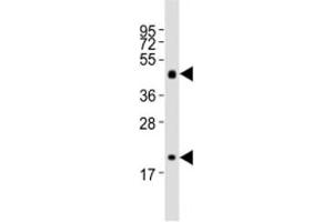Western blot testing of Shh antibody at 1:2000 dilution + mouse stomach lysate
