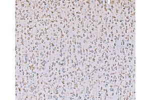 IHC analysis of SND1 using anti-SND1 antibody (ABIN7600525). (SND1 anticorps  (AA 20-204))