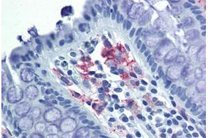 anti-CD209 (CD209) antibody