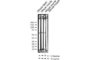 Western blot analysis of Phospho-FOXO4 (Thr451) expression in various lysates