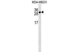 TNFRSF17 Antibody (Center) western blot analysis in MDA-MB231 cell line lysates (35 µg/lane). (BCMA anticorps  (Middle Region))