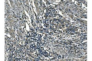 IHC analysis of ATP6V1A using anti-ATP6V1A antibody (ABIN7599916).