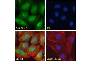 ABIN185293 Immunofluorescence analysis of paraformaldehyde fixed U2OS cells, permeabilized with 0. (NR1H2 anticorps  (N-Term))