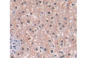 Used in DAB staining on fromalin fixed paraffin- embedded liver tissue (Acetyl-CoA Carboxylase beta anticorps  (AA 29-249))