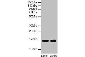 Western blot All lanes: Guinea Pig Hemoglobin antibody at 2 μg/mL Lane 1: Guinea Pig serum at 1: 100 Lane 2: Guinea Pig serum at 1: 1000 Secondary Goat polyclonal to rabbit IgG at 1/15000 dilution Predicted band size: 16 kDa Observed band size: 16 kDa (Hemoglobin anticorps)