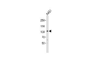Western blot analysis of lysate from A431 cell line, using COL6A1 Antibody (C-term) (ABIN390513 and ABIN2840867).