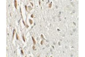 Immunohistochemical analysis of TSHZ3 in mouse brain tissue with TSHZ3 polyclonal antibody  at 2. (TSHZ3 anticorps  (N-Term))