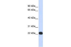 WB Suggested Anti-RCVRN Antibody Titration:  0. (Recoverin anticorps  (N-Term))