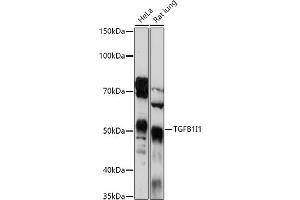 Western blot analysis of extracts of various cell lines, using TGFB1I1 antibody (ABIN6129144, ABIN6149074, ABIN6149075 and ABIN6224526) at 1:1000 dilution. (TGFB1I1 anticorps  (AA 1-150))