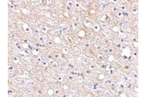 Immunohistochemical staining of human brain tissue using PLXDC2 polyclonal antibody  at 2. (PLXDC2 anticorps  (N-Term))