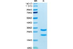 Biotinylated Rat MASP2 on Tris-Bis PAGE under reduced condition.