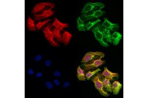 ABIN6263235 and ABIN6278161 staining Hela cells by IF/ICC. (MFN2 anticorps  (N-Term))
