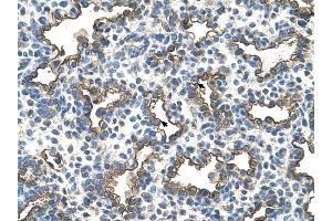Podoplanin antibody was used for immunohistochemistry at a concentration of 4-8 ug/ml to stain Alveolar cells (arrows) in Human Lung.