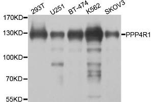 Western blot analysis of extracts of various cell lines, using PPP4R1 antibody. (PPP4R1 anticorps)