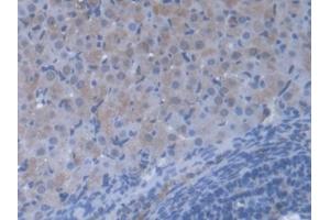 DAB staining on IHC-P; Samples: Mouse Ovary Tissue (VARS anticorps  (AA 186-421))