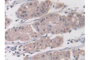 Detection of LMP7 in Human Stomach Tissue using Polyclonal Antibody to Large Multifunctional Peptidase 7 (LMP7)