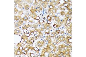 Immunohistochemistry of paraffin-embedded human liver using Cytochrome P450 4A (CYP4) (CYP4) Rabbit mAb (ABIN7266658) at dilution of 1:100 (40x lens).