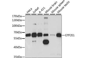 Western blot analysis of extracts of various cell lines, using GTF2E1 antibody (ABIN7267371) at 1:1000 dilution.