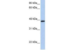 Aquaporin 10 antibody used at 1 ug/ml to detect target protein. (Aquaporin 10 anticorps  (C-Term))