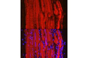 Immunofluorescence analysis of mouse skeletal muscle using Fbx32/FBOX32 Rabbit pAb (ABIN6134167, ABIN6140522 and ABIN7101804) at dilution of 1:100 (40x lens). (FBXO32 anticorps)