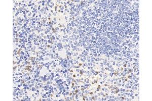 Immunohistochemistry analysis of paraffin-embedded mouse spleen using CCR5 Polyclonal Antibody at dilution of 1:300. (CCR5 anticorps)
