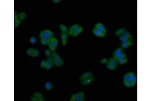 Immunofluorescent analysis of HepG2 cells using ABIN7144709 at dilution of 1:100 and Alexa Fluor 488-congugated AffiniPure Goat Anti-Rabbit IgG(H+L)