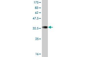 Western Blot detection against Immunogen (33. (ATOX1 anticorps  (AA 1-68))