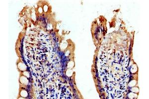 IHC image of ABIN7174344 diluted at 1:200 and staining in paraffin-embedded human small intestine tissue performed on a Leica BondTM system.