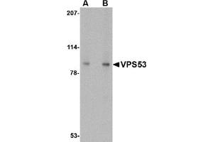 Western blot analysis of VPS53 in 293 cell lysate with VPS53 antibody at (A) 0. (VPS53 anticorps  (C-Term))