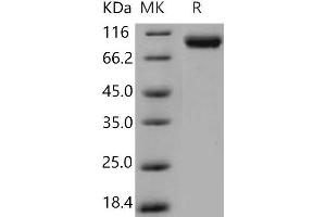 Western Blotting (WB) image for Vascular Cell Adhesion Molecule 1 (VCAM1) (Active) protein (His tag) (ABIN7198676)