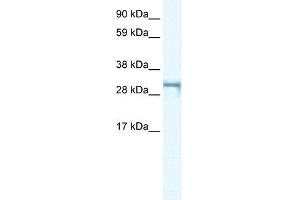 WB Suggested Anti-SHOX2 Antibody Titration: 0. (SHOX2 anticorps  (Middle Region))