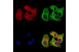 Clathrin heavy chain Antibody staining Hela cells by IF/ICC. (Clathrin Heavy Chain (CLTC) (Heavy Chain), (Internal Region) anticorps)