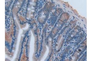DAB staining on IHC-P; Samples: Rat Intestine Tissue (TNFSF14 anticorps  (AA 58-239))