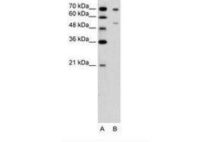 Image no. 1 for anti-Forkhead Box B2 (FOXB2) (AA 51-100) antibody (ABIN6736646) (FOXB2 anticorps  (AA 51-100))