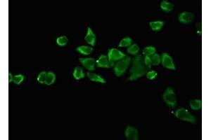 Immunofluorescence staining of Ntera-2 cells with ABIN7164068 at 1:100, counter-stained with DAPI.