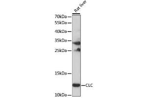 Western blot analysis of extracts of Rat liver, using CLC antibody (ABIN6292448) at 1:1000 dilution. (Galectin 10 anticorps)