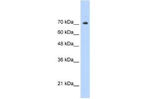 WB Suggested Anti-STAT1 Antibody Titration:  0. (STAT1 anticorps  (C-Term))