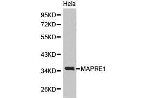 Western Blotting (WB) image for anti-Ankyrin Repeat and Sterile alpha Motif Domain Containing 1B (ANKS1B) antibody (ABIN1873638) (ANKS1B anticorps)