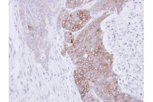 IHC-P Image Immunohistochemical analysis of paraffin-embedded DLD1 xenograft, using RAB3C, antibody at 1:500 dilution.