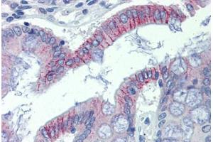 Colon, Human: Formalin-Fixed, Paraffin-Embedded (FFPE)